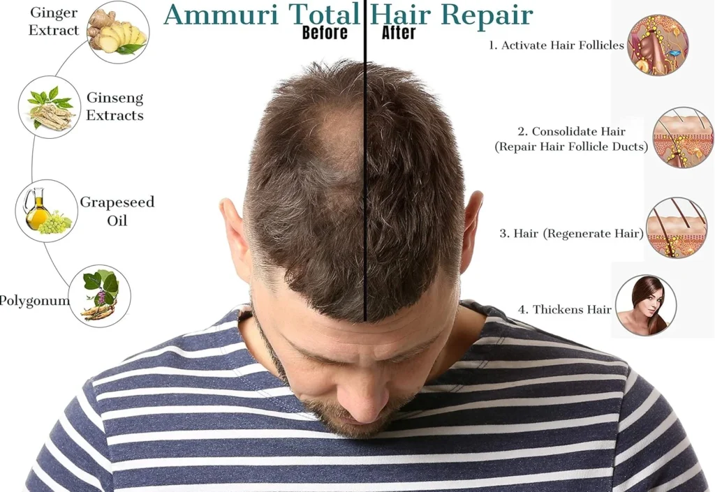 Ammuri Hair Nourishing Serum - Natural Herbal Hair Care Serum for Stronger, Healthier Looking Hair - Scalp Nourishing Formula for Men and Women 30ml