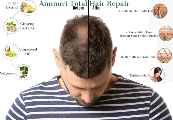 Ammuri Hair Nourishing Serum - Natural Herbal Hair Care Serum for Stronger, Healthier Looking Hair - Scalp Nourishing Formula for Men and Women 30ml